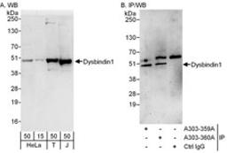 Detection of human Dysbindin1 by western blot and immunoprecipitation.