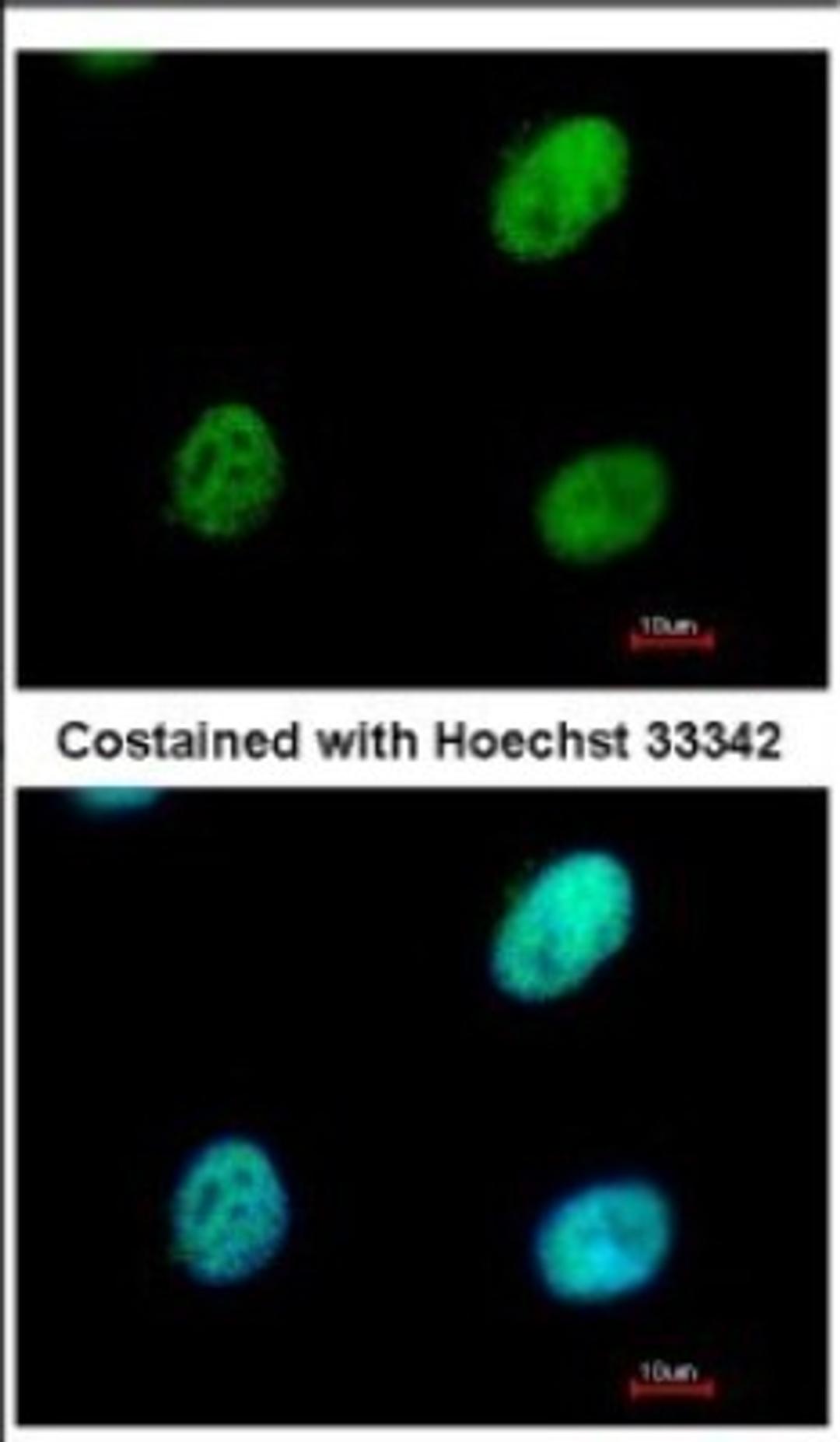 Immunocytochemistry/Immunofluorescence: RALY Antibody [NBP2-20065] - Immunofluorescence analysis of paraformaldehyde-fixed HeLa, using antibody at 1:500 dilution.