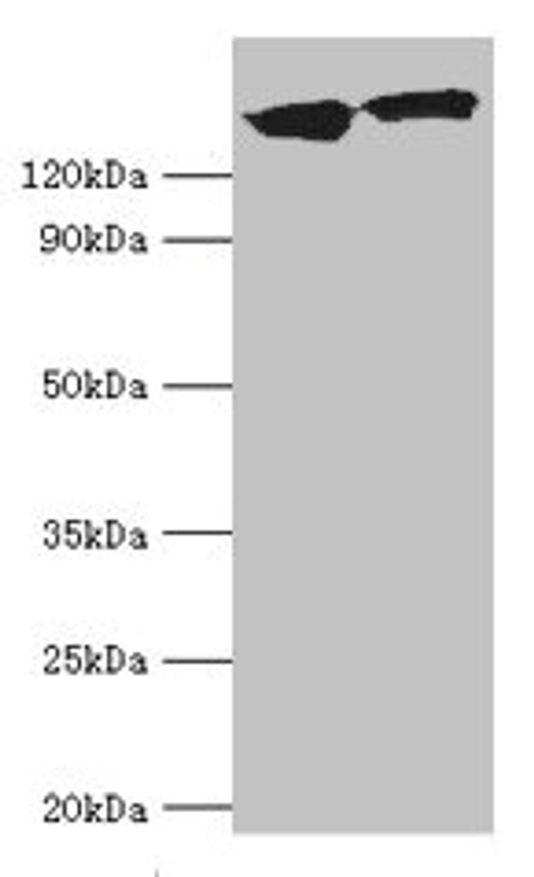 Western blot. All lanes: DCTN1 antibody at 20µg/ml. Lane 1: Mouse brain tissue. Lane 2: Jurkat whole cell lysate. Secondary. Goat polyclonal to rabbit IgG at 1/10000 dilution. Predicted band size: 142, 128, 137, 139, 127, 141 kDa. Observed band size: 142 kDa