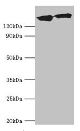 Western blot. All lanes: DCTN1 antibody at 20µg/ml. Lane 1: Mouse brain tissue. Lane 2: Jurkat whole cell lysate. Secondary. Goat polyclonal to rabbit IgG at 1/10000 dilution. Predicted band size: 142, 128, 137, 139, 127, 141 kDa. Observed band size: 142 kDa