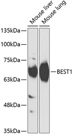 Western blot - BEST1 antibody (A14070)