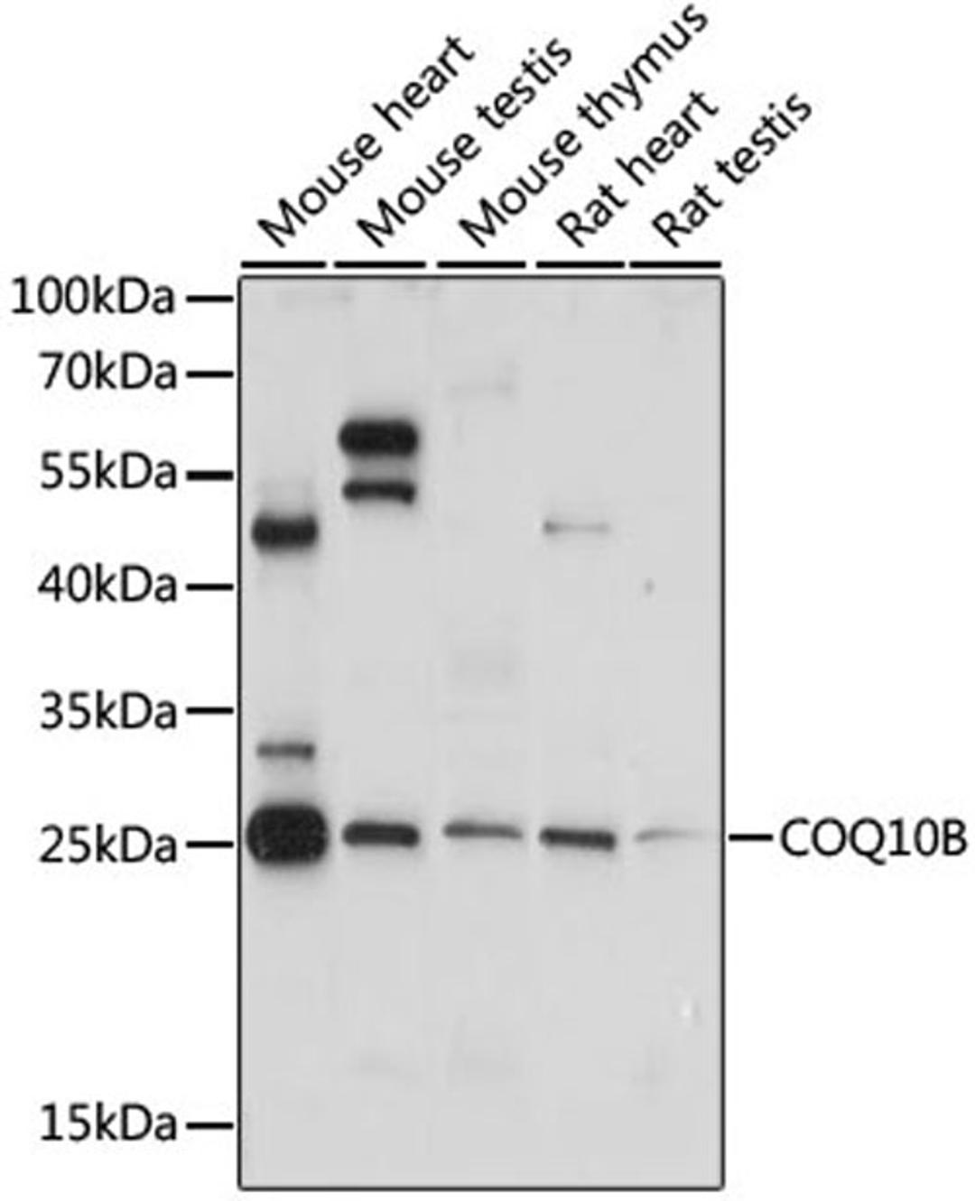 Western blot - COQ10B antibody (A15193)