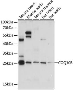 Western blot - COQ10B antibody (A15193)