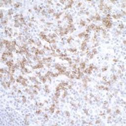 Detection of human CD8 alpha by immunohistochemistry.