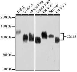 Western blot - CD166 Rabbit mAb (A9727)