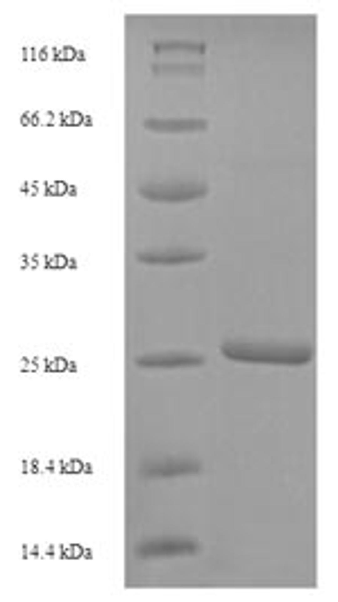 (Tris-Glycine gel) Discontinuous SDS-PAGE (reduced) with 5% enrichment gel and 15% separation gel.