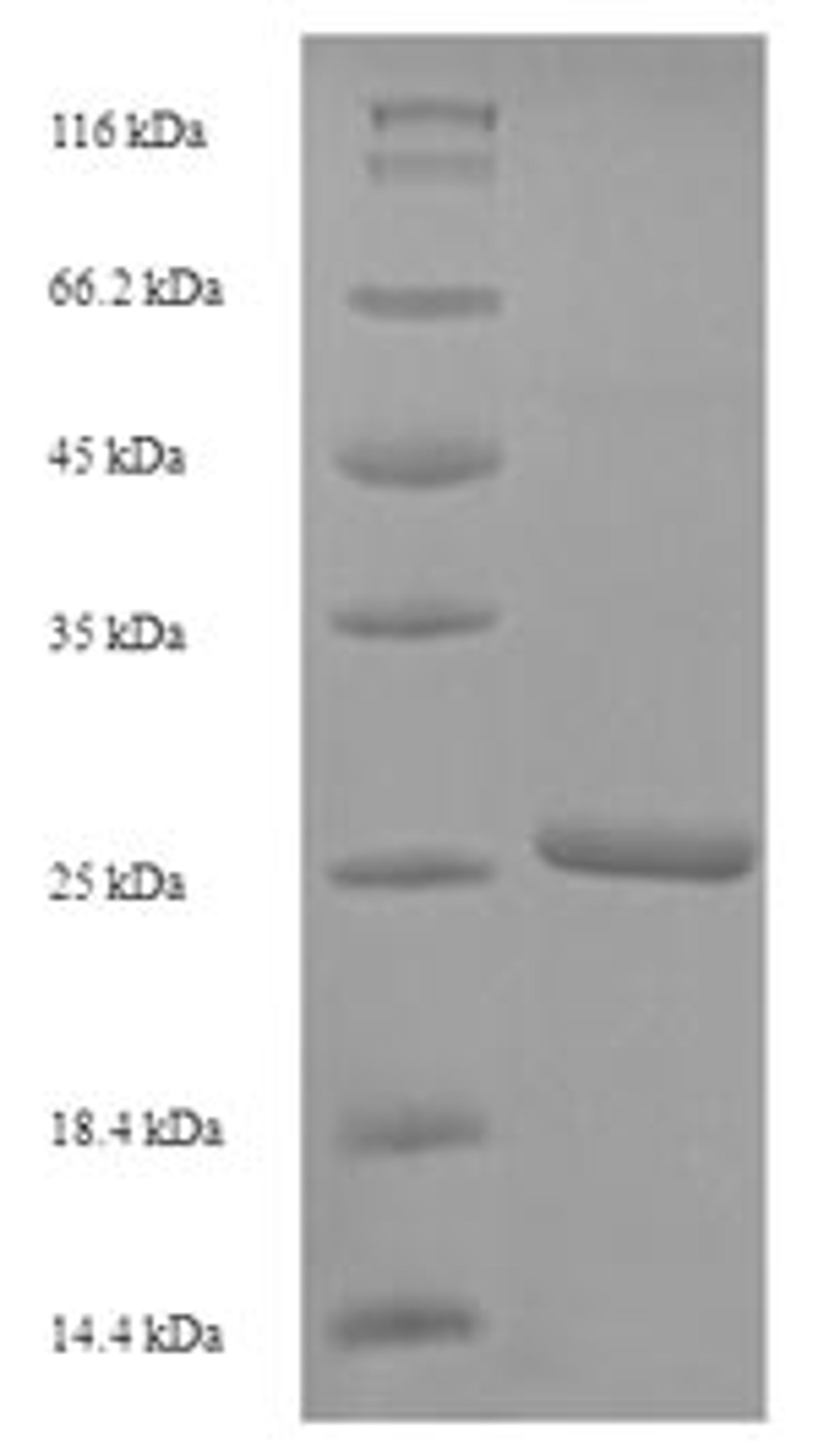 (Tris-Glycine gel) Discontinuous SDS-PAGE (reduced) with 5% enrichment gel and 15% separation gel.