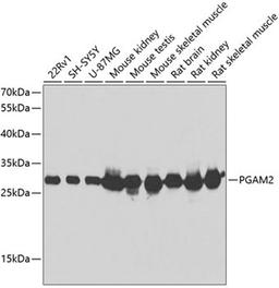 Western blot - PGAM2 antibody (A7917)