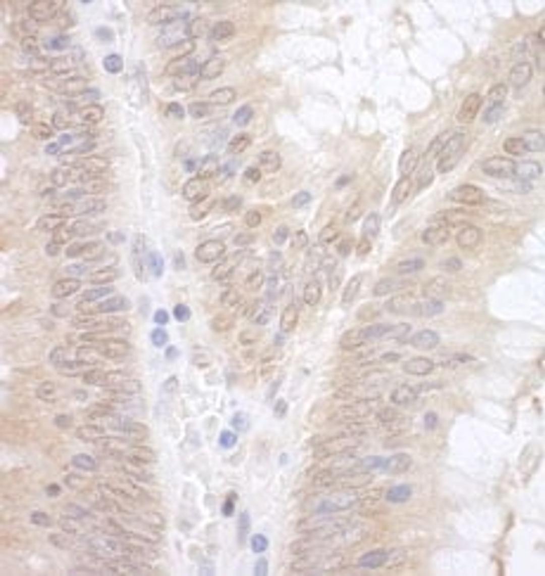 Detection of human EAF2 by immunohistochemistry.