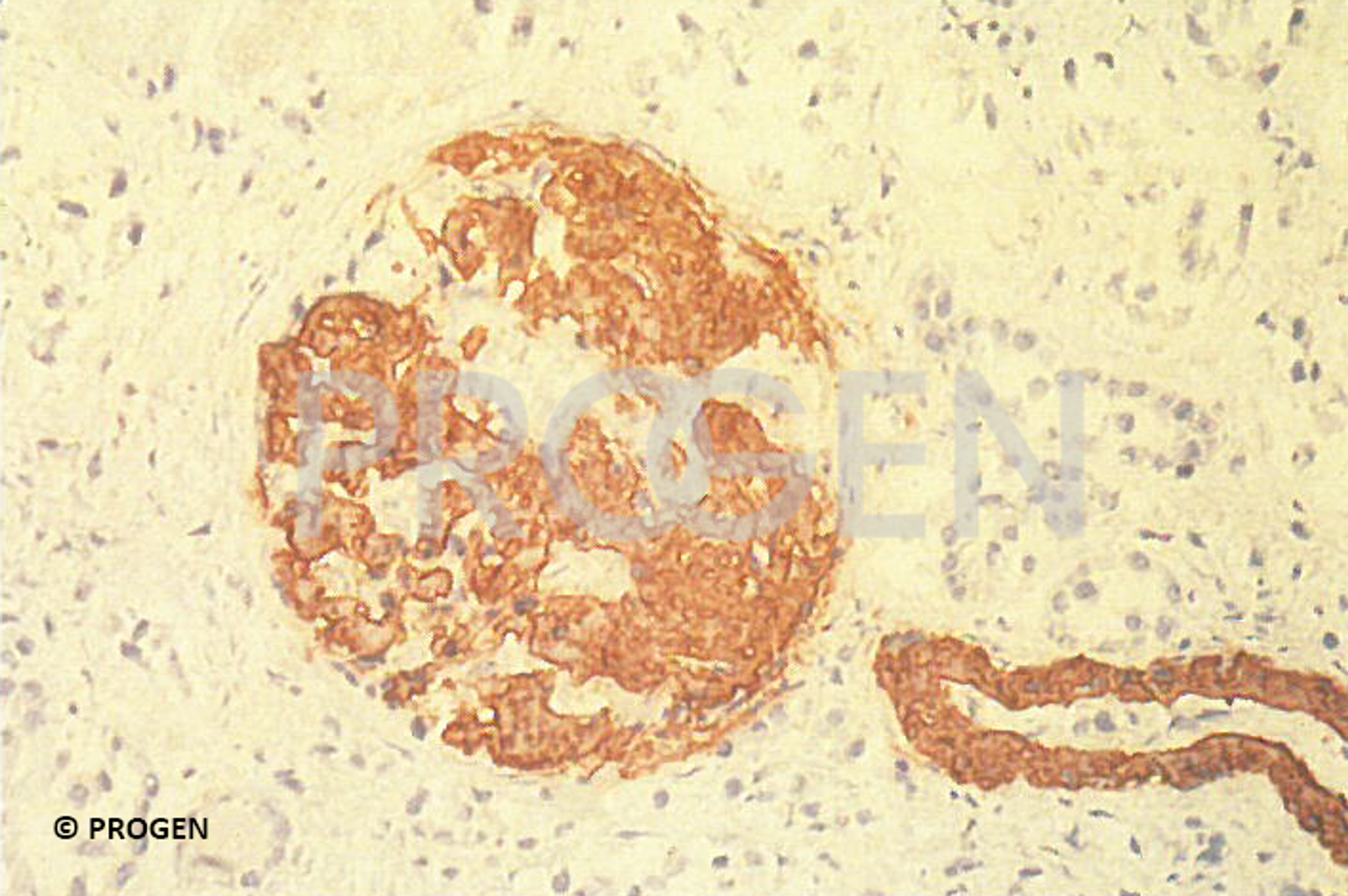 human glomerulus