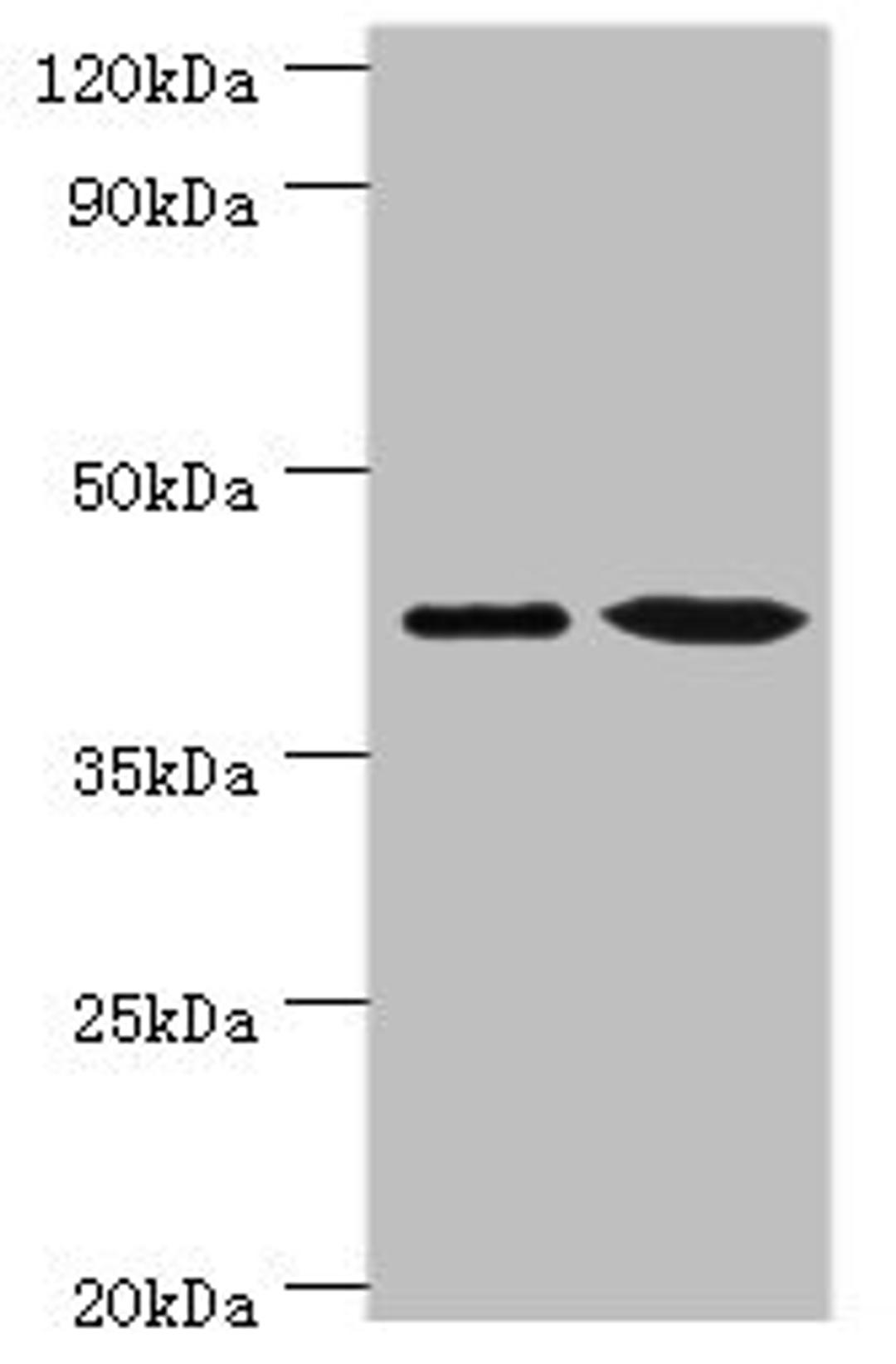 Western blot. All lanes: Endoplasmic reticulum-Golgi intermediate compartment protein 2 antibody at 4ug/ml. Lane 1: HepG2 whole cell lysate. Lane 2: Jurkat whole cell lysate. Secondary. Goat polyclonal to rabbit IgG at 1/10000 dilution. Predicted band size: 43 kDa. Observed band size: 43 kDa. 