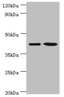 Western blot. All lanes: Endoplasmic reticulum-Golgi intermediate compartment protein 2 antibody at 4ug/ml. Lane 1: HepG2 whole cell lysate. Lane 2: Jurkat whole cell lysate. Secondary. Goat polyclonal to rabbit IgG at 1/10000 dilution. Predicted band size: 43 kDa. Observed band size: 43 kDa. 