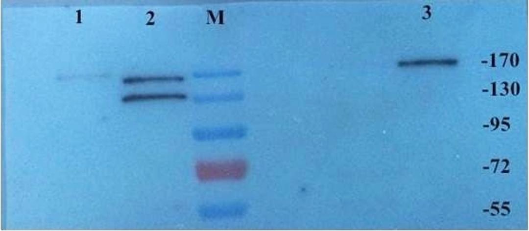 Western blot analysis of rat brain (Lane1), rat kidney (Lane2) and mouse brain tissue (Lane3) using CD206 antibody (Dilution at 1:500)