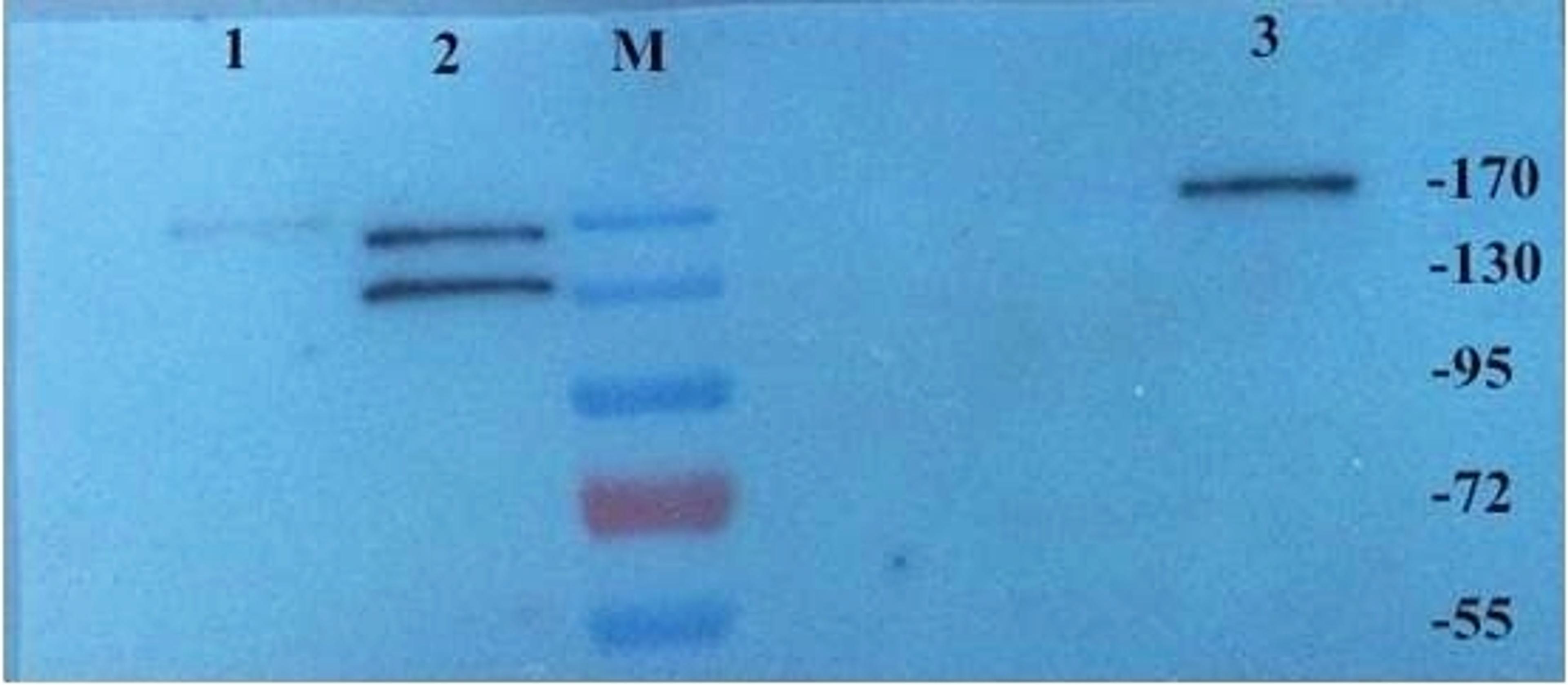 Western blot analysis of rat brain (Lane1), rat kidney (Lane2) and mouse brain tissue (Lane3) using CD206 antibody (Dilution at 1:500)