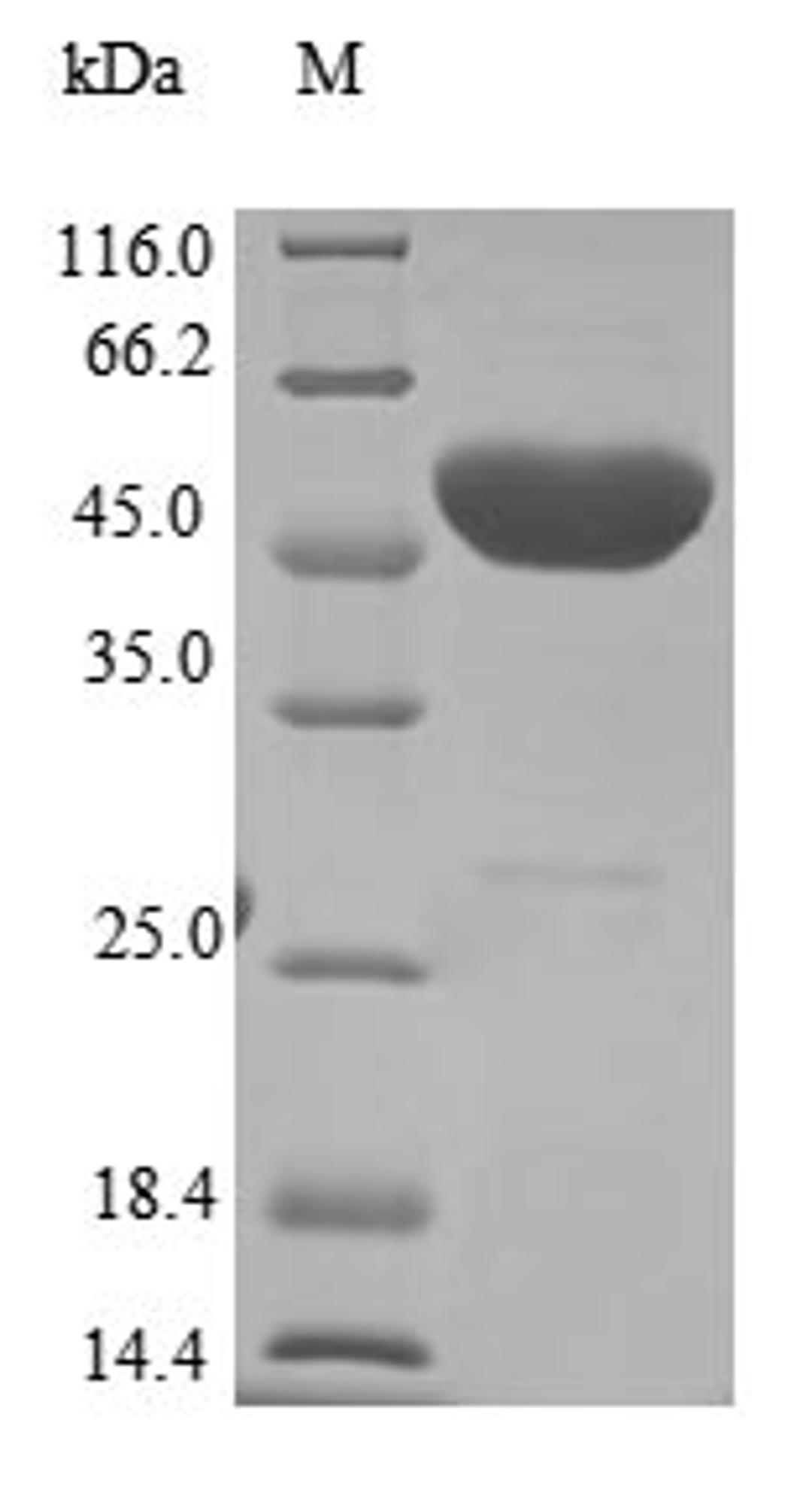 (Tris-Glycine gel) Discontinuous SDS-PAGE (reduced) with 5% enrichment gel and 15% separation gel.