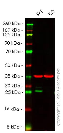 Western blot - Anti-Bcl-2 antibody [EPR17509] (ab182858)