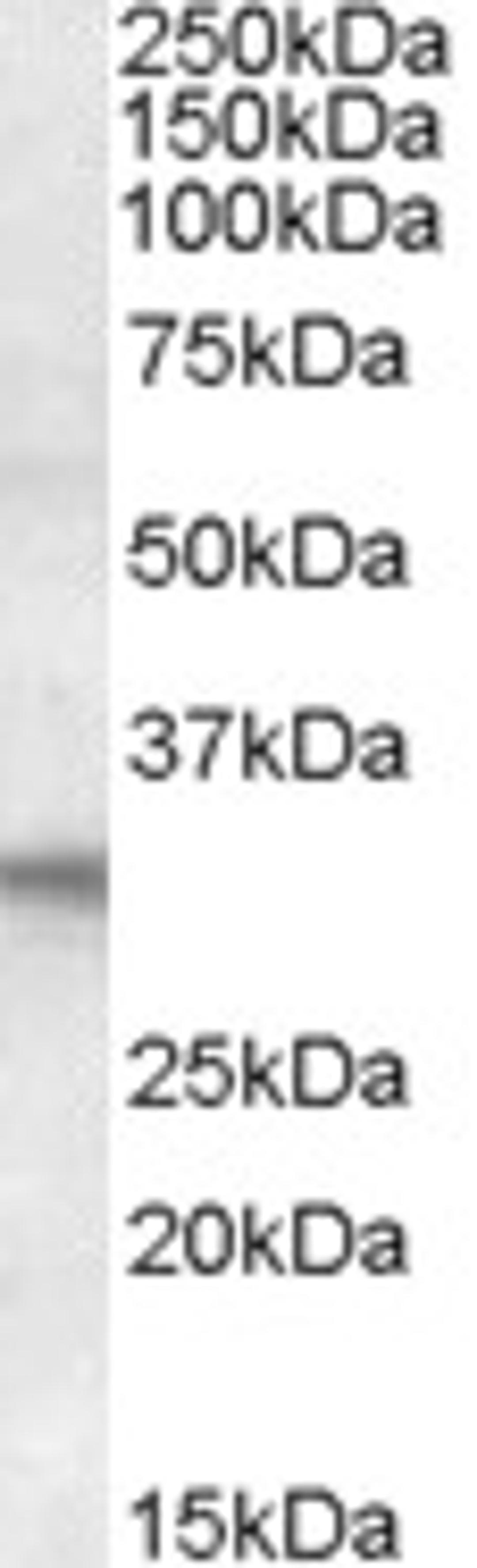 45-592 (1ug/ml) staining of Human Heart lysate (35ug protein in RIPA buffer). Primary incubation was 1 hour. Detected by chemiluminescence.