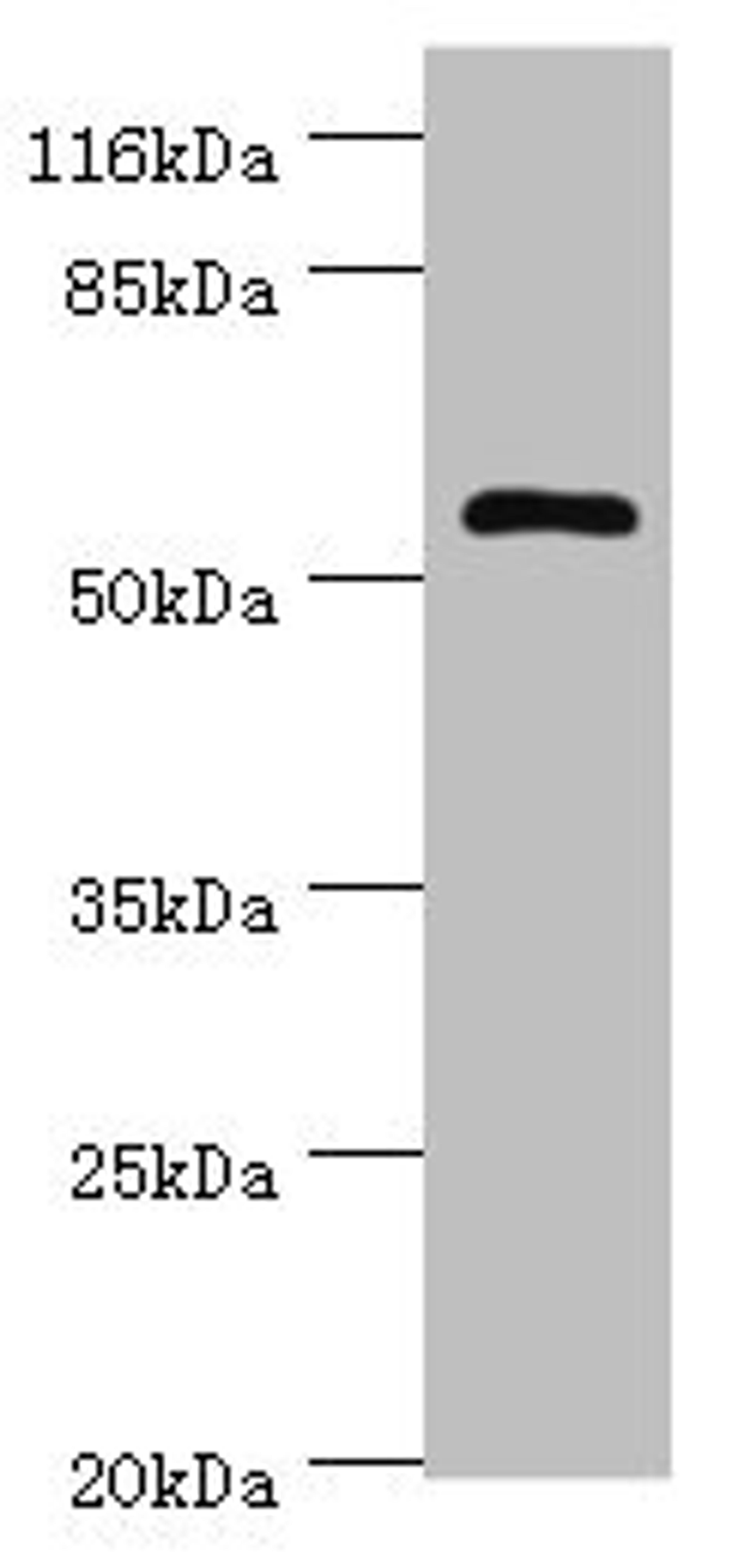 Western blot. All lanes: DPH2 antibody at 2µg/ml + Mouse brain tissue. Secondary. Goat polyclonal to rabbit IgG at 1/10000 dilution. Predicted band size: 53, 28, 39 kDa. Observed band size: 53 kDa