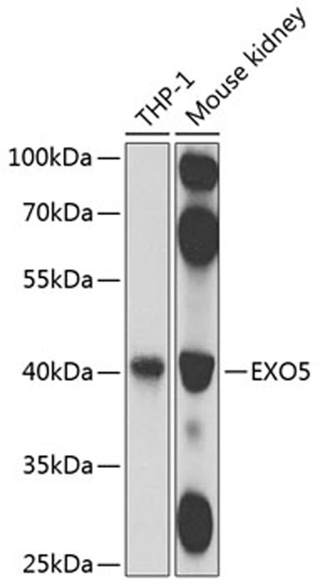 Western blot - EXO5 antibody (A8507)