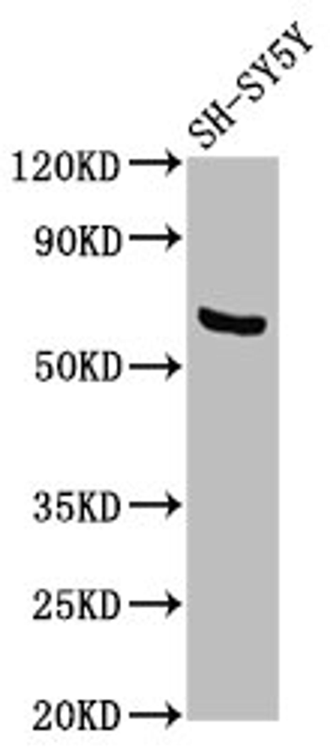 Western Blot. Positive WB detected in: SH-SY5Y whole cell lysate. All lanes: PDP1 antibody at 3.6µg/ml. Secondary. Goat polyclonal to rabbit IgG at 1/50000 dilution. Predicted band size: 62, 64 kDa. Observed band size: 62 kDa