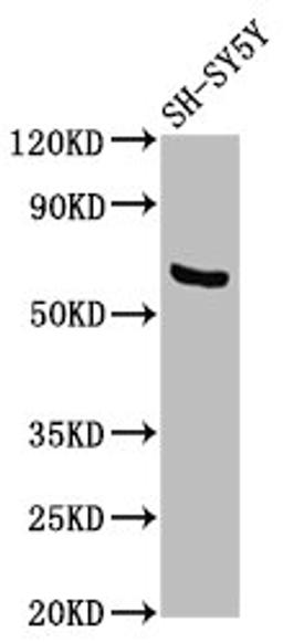 Western Blot. Positive WB detected in: SH-SY5Y whole cell lysate. All lanes: PDP1 antibody at 3.6µg/ml. Secondary. Goat polyclonal to rabbit IgG at 1/50000 dilution. Predicted band size: 62, 64 kDa. Observed band size: 62 kDa