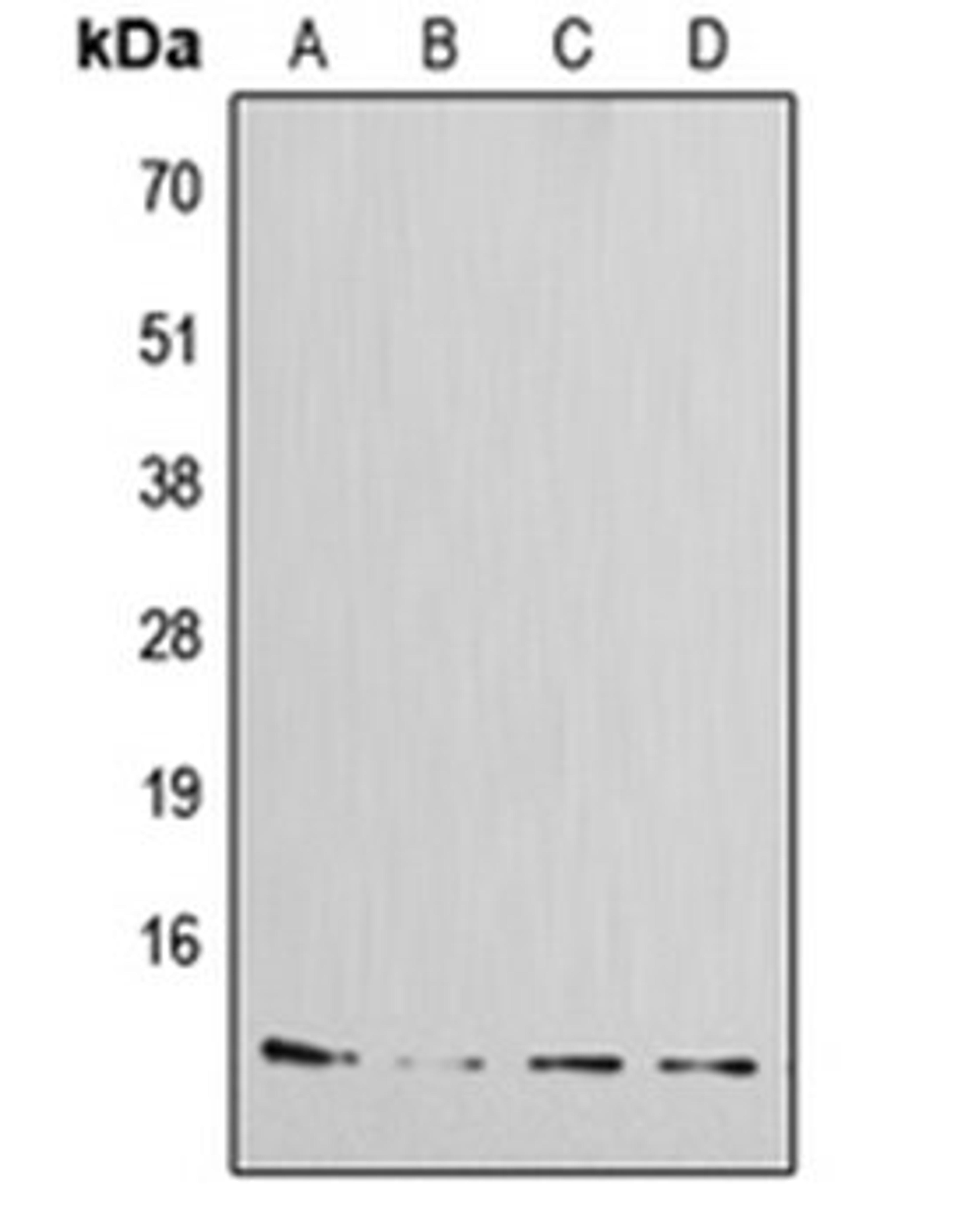 Western blot analysis of MCF7 (Lane 1), HeLa (Lane 2), mouse kidney (Lane 3), rat kidney (Lane 4) whole cell lysates using IAPP antibody