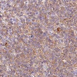 Immunohistochemistry: DOK6 Antibody [NBP2-32609] - lymphoma