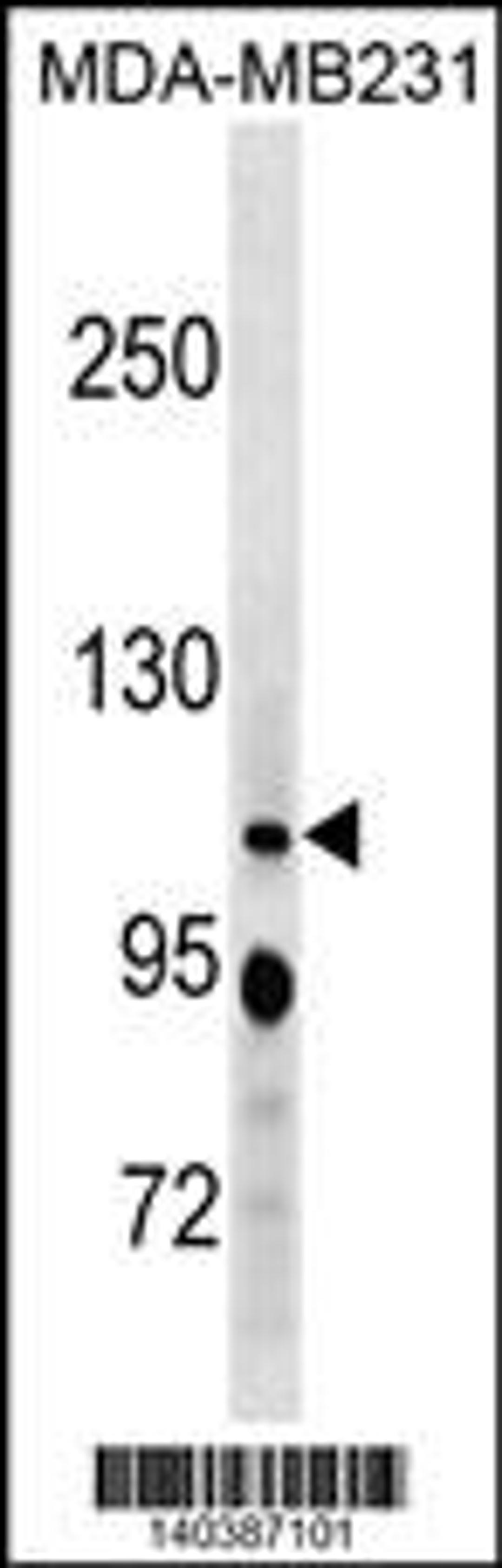 Western blot analysis in MDA-MB231 cell line lysates (35ug/lane).