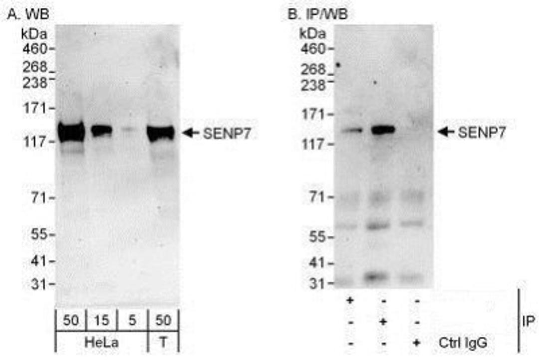 Western Blot: SENP7 Antibody [NBP1-50027] - Detection of Human SENP7 by Western Blot and Immunoprecipitation.  Samples:  Whole cell lysate from HeLa (5, 15 and 50 mcg for WB; 1 mg for IP, 20% of IP loaded) and 293T (T; 50 mcg) cells.  Antibodies: Affinity purified rabbit anti-SENP7 antibody used for WB at 0.4 mcg/ml (A) and 1 mcg/ml (B) and used for IP at 6 mcg/mg lysate.  SENP7 was also immunoprecipitated by rabbit anti-SENP7 antibody BL10697, which recognizes an upstream epitope.  For blotting immunoprecipitated SENP7, the ReliaBLOT  Reagents and Procedures were used.  Detection: Chemiluminescence with exposure times of 3 minutes (A) and 30 seconds (B).