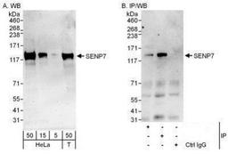 Western Blot: SENP7 Antibody [NBP1-50027] - Detection of Human SENP7 by Western Blot and Immunoprecipitation.  Samples:  Whole cell lysate from HeLa (5, 15 and 50 mcg for WB; 1 mg for IP, 20% of IP loaded) and 293T (T; 50 mcg) cells.  Antibodies: Affinity purified rabbit anti-SENP7 antibody used for WB at 0.4 mcg/ml (A) and 1 mcg/ml (B) and used for IP at 6 mcg/mg lysate.  SENP7 was also immunoprecipitated by rabbit anti-SENP7 antibody BL10697, which recognizes an upstream epitope.  For blotting immunoprecipitated SENP7, the ReliaBLOT  Reagents and Procedures were used.  Detection: Chemiluminescence with exposure times of 3 minutes (A) and 30 seconds (B).