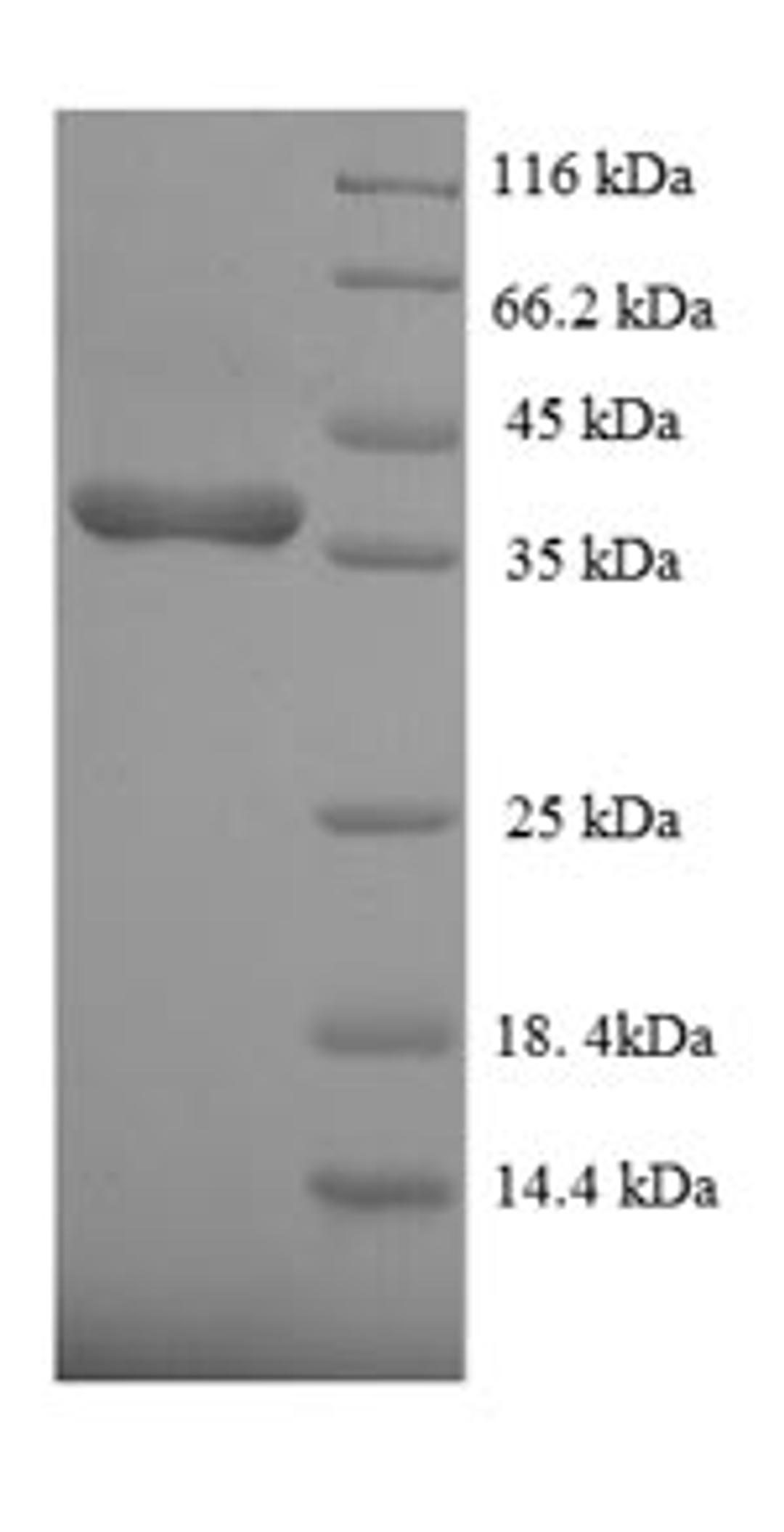 (Tris-Glycine gel) Discontinuous SDS-PAGE (reduced) with 5% enrichment gel and 15% separation gel.