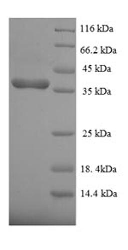 (Tris-Glycine gel) Discontinuous SDS-PAGE (reduced) with 5% enrichment gel and 15% separation gel.