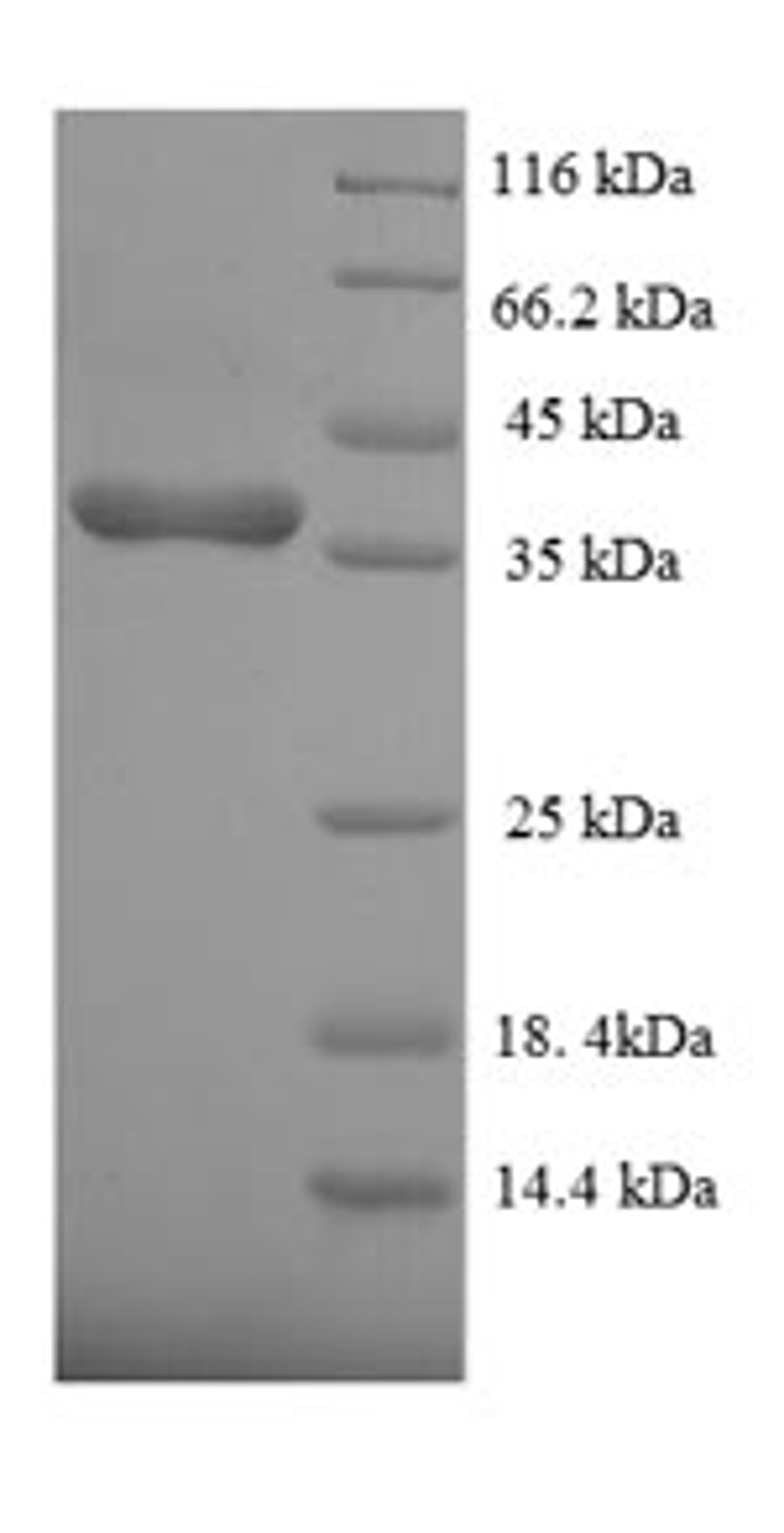 (Tris-Glycine gel) Discontinuous SDS-PAGE (reduced) with 5% enrichment gel and 15% separation gel.