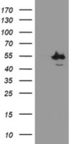 Western Blot: CHN 1 Antibody (2G6) [NBP2-46290] - Analysis of HEK293T cells were transfected with the pCMV6-ENTRY control (Left lane) or pCMV6-ENTRY CHN 1.