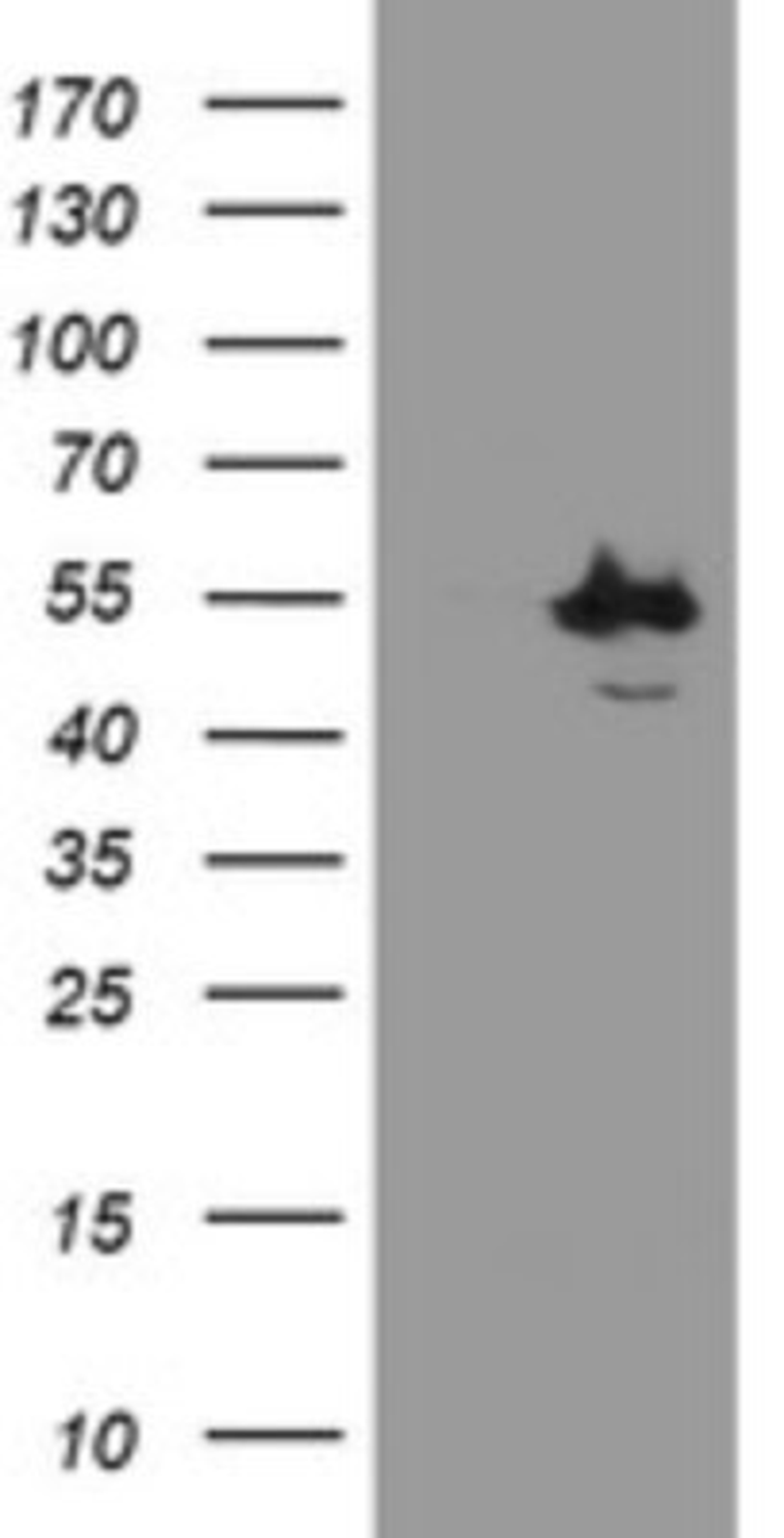 Western Blot: CHN 1 Antibody (2G6) [NBP2-46290] - Analysis of HEK293T cells were transfected with the pCMV6-ENTRY control (Left lane) or pCMV6-ENTRY CHN 1.