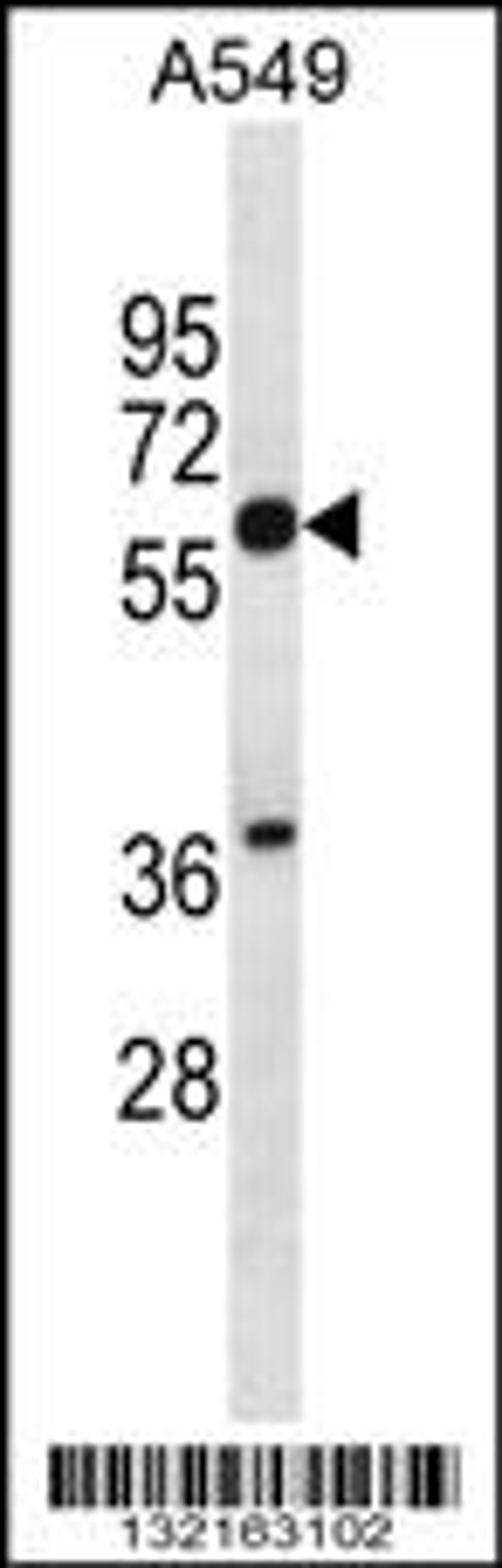 Western blot analysis in A549 cell line lysates (35ug/lane).