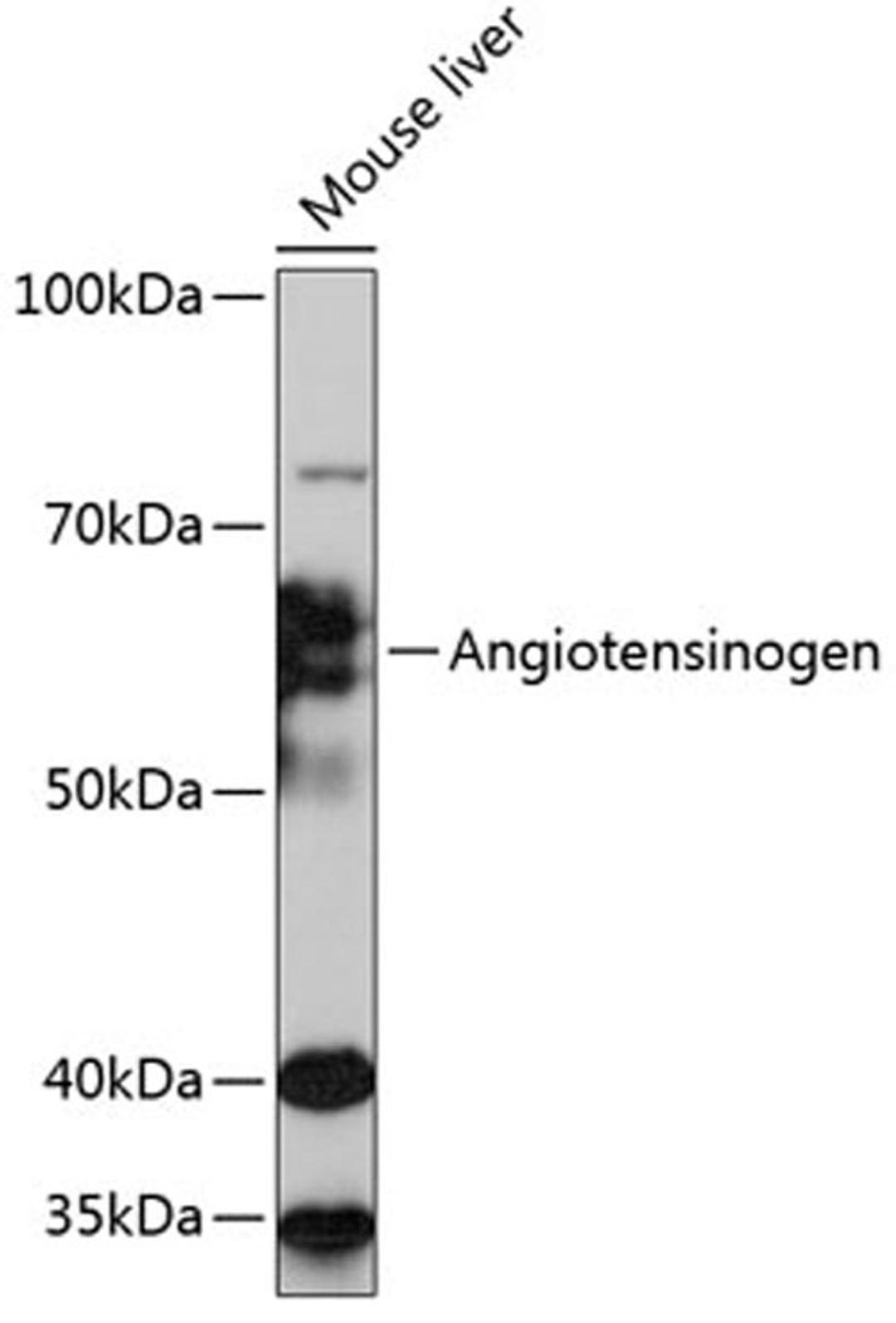 Western blot - Angiotensinogen Rabbit mAb (A11689)