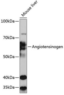 Western blot - Angiotensinogen Rabbit mAb (A11689)