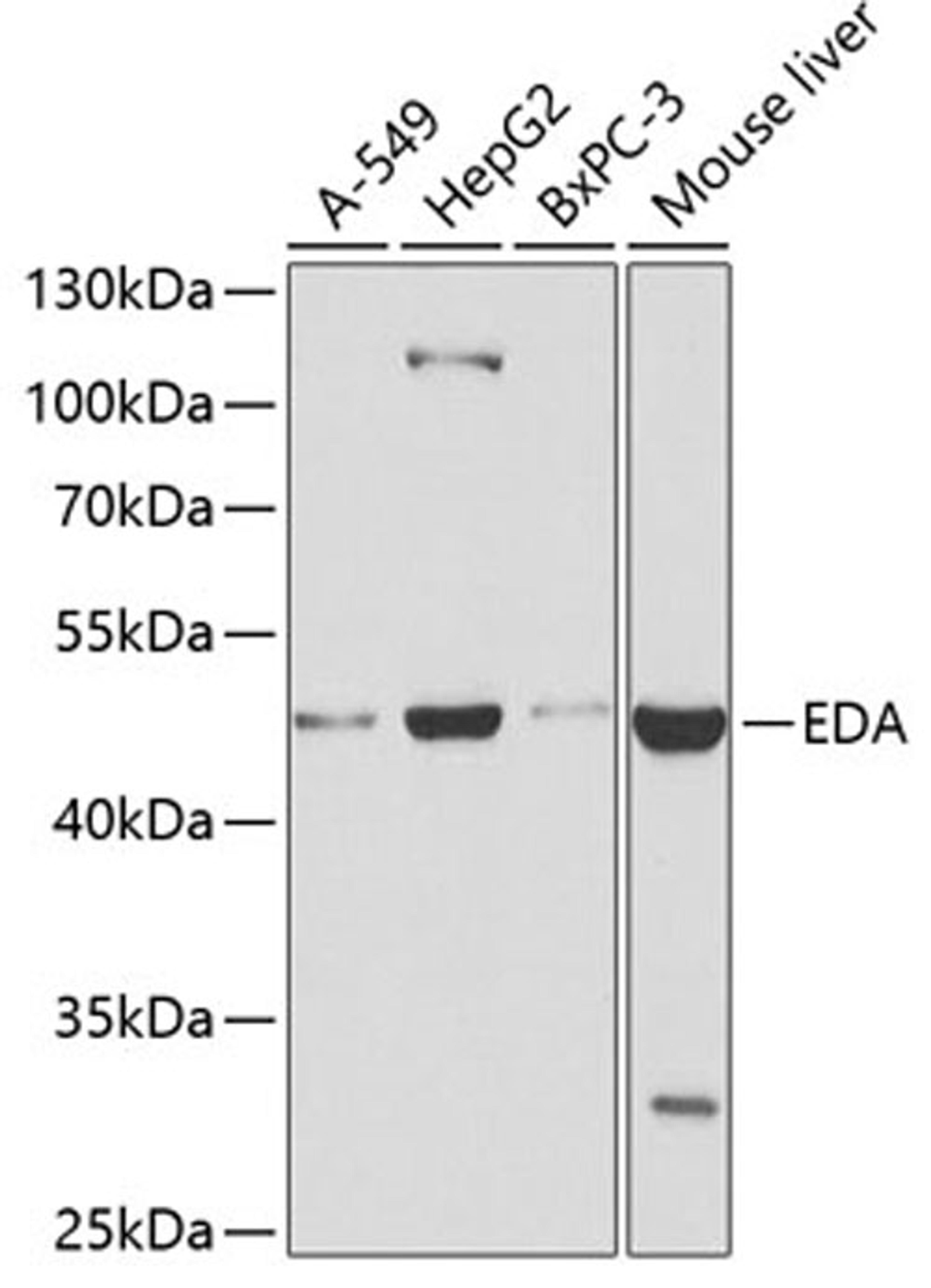 Western blot - EDA antibody (A2905)