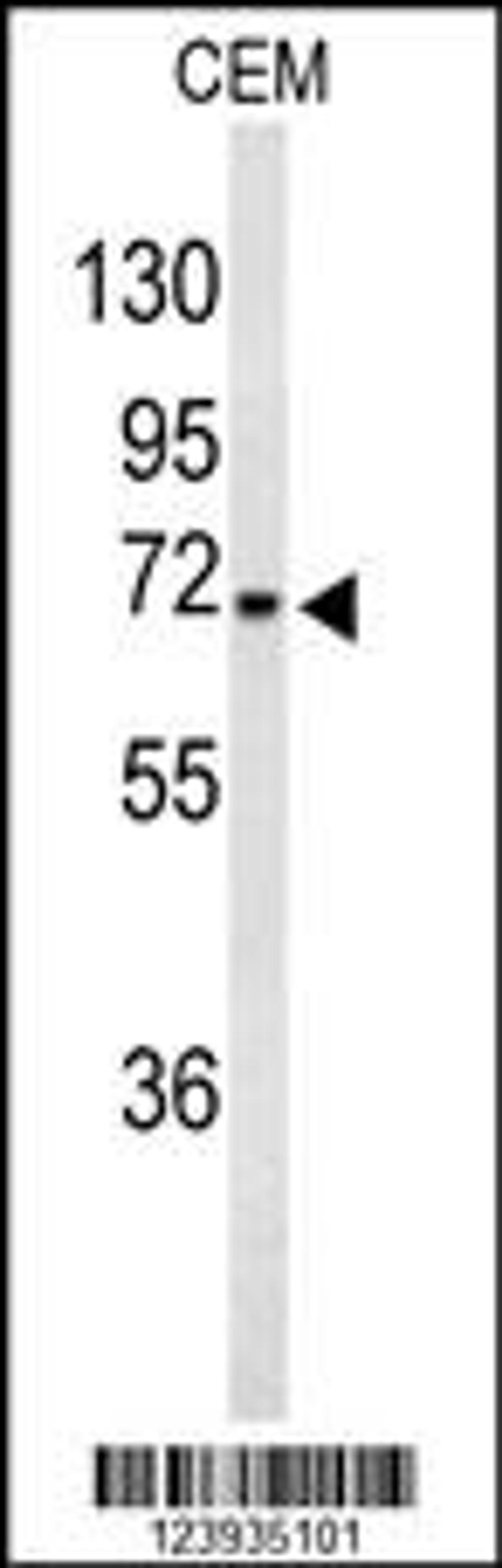 Western blot analysis of GABRA4 Antibody in CEM cell line lysates (35ug/lane)