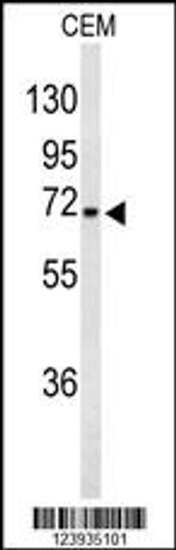 Western blot analysis of GABRA4 Antibody in CEM cell line lysates (35ug/lane)