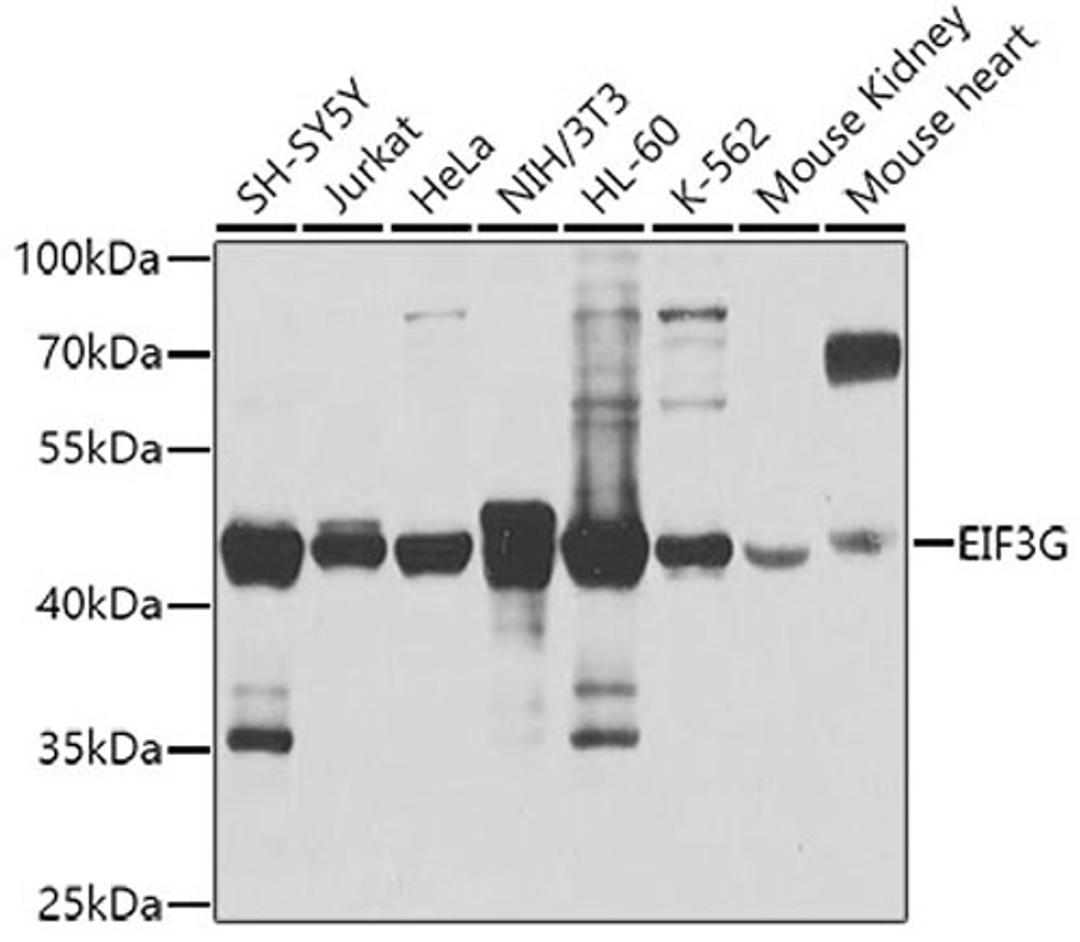 Western blot - EIF3G antibody (A4240)