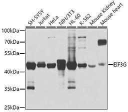 Western blot - EIF3G antibody (A4240)