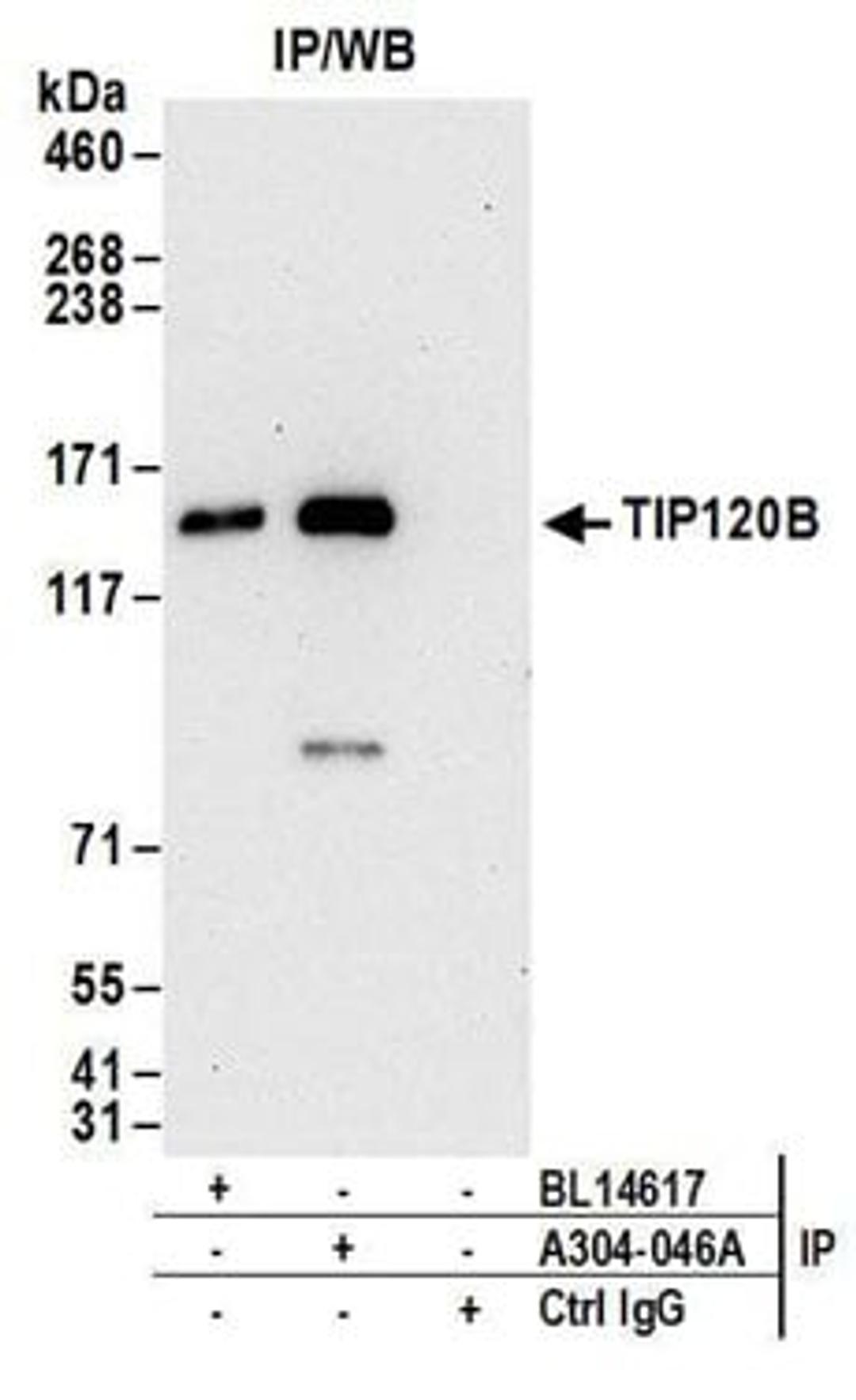 Detection of human TIP120B by western blot of immunoprecipitates.