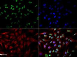 Immunocytochemistry/Immunofluorescence: Cited-2 Antibody (JA22) [NB100-136] - The Cited-2 (JA22) antibody was tested at a 1:250 dilution in HeLa cells against Dylight 488 (Green). Beta-tubulin and nuclei were counterstained against Dylight 550 (Red) and DAPI (Blue).