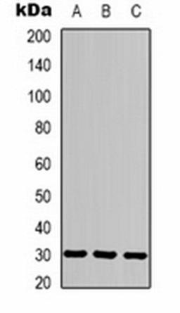 Western blot analysis of human brain (Lane 1), mouse brain (Lane 2), rat brain (Lane 3) whole cell lysates using CACNG3 antibody