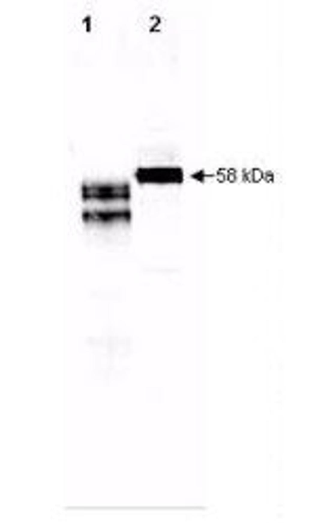 Western blot analysis of human plasma Lane 1 contains 250 ng of purified human fetuin Lane 2 contains 5 ul of a 1:50 dilution of human serum using Fetuin antibody