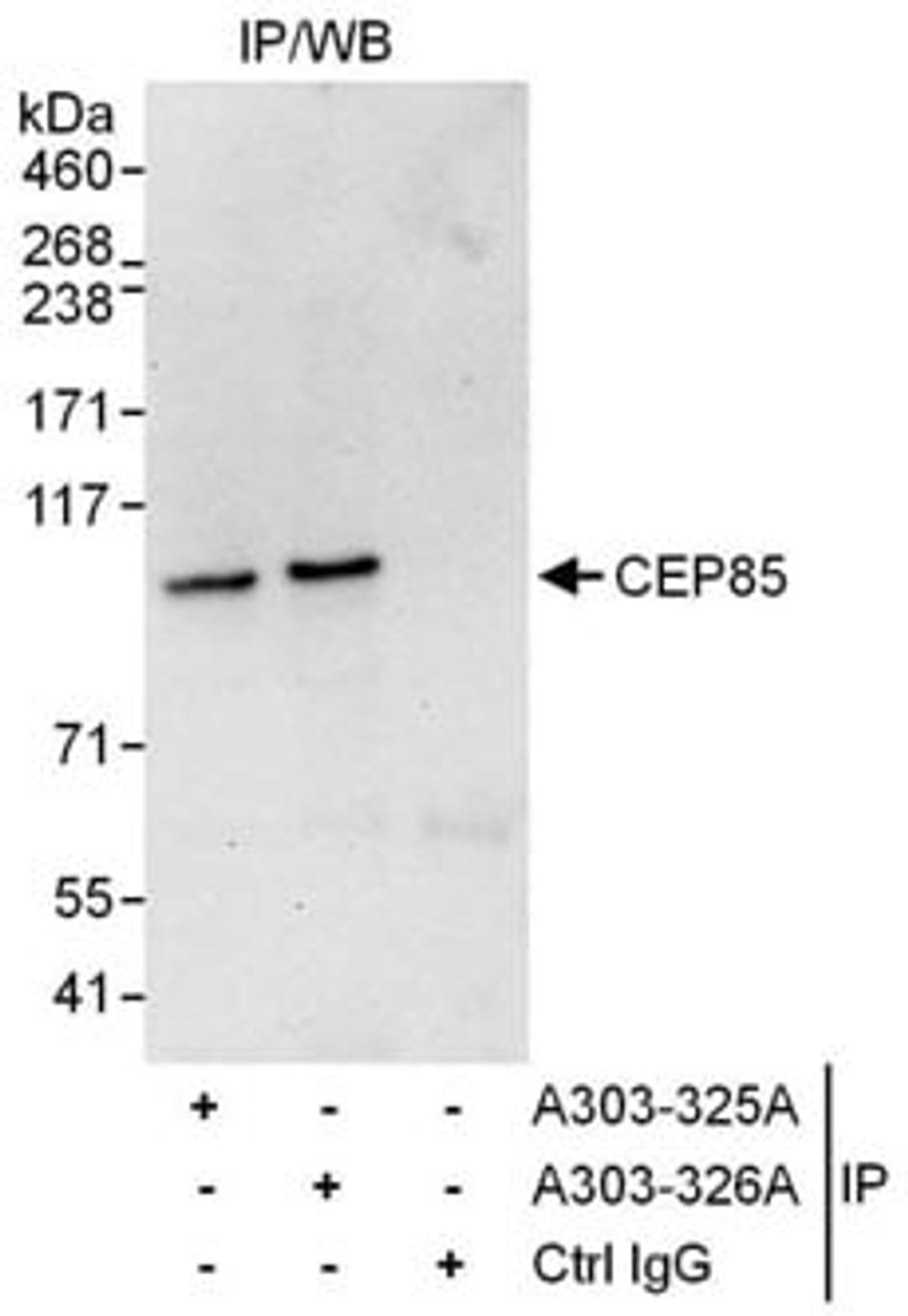 Detection of human CEP85 by western blot of immunoprecipitates.