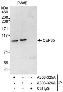 Detection of human CEP85 by western blot of immunoprecipitates.