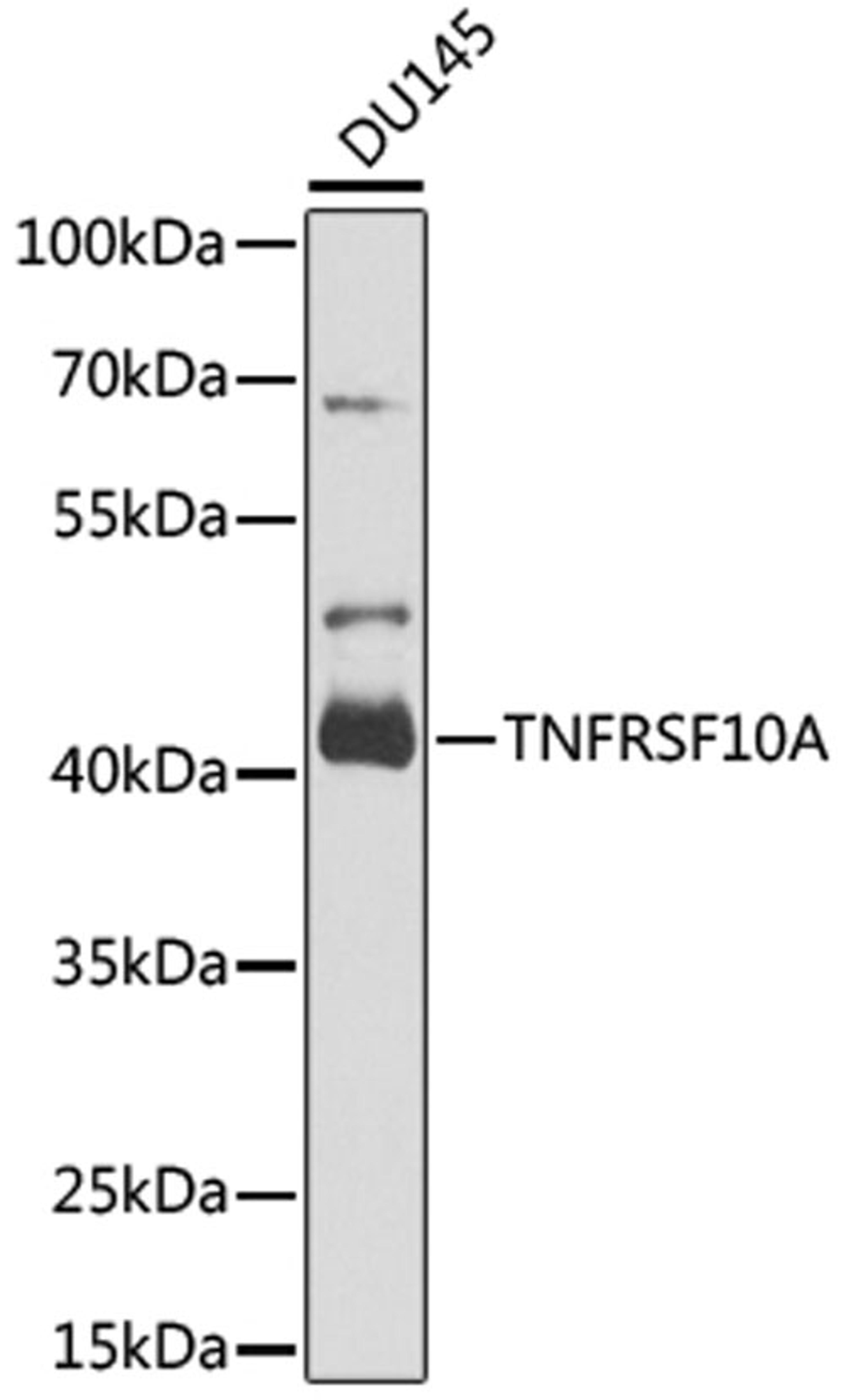 Western blot - TNFRSF10A antibody (A6267)